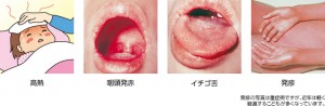 str_image02[1]